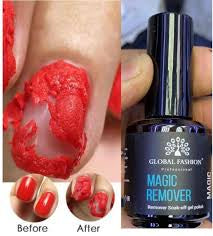 Global fashion gel remover